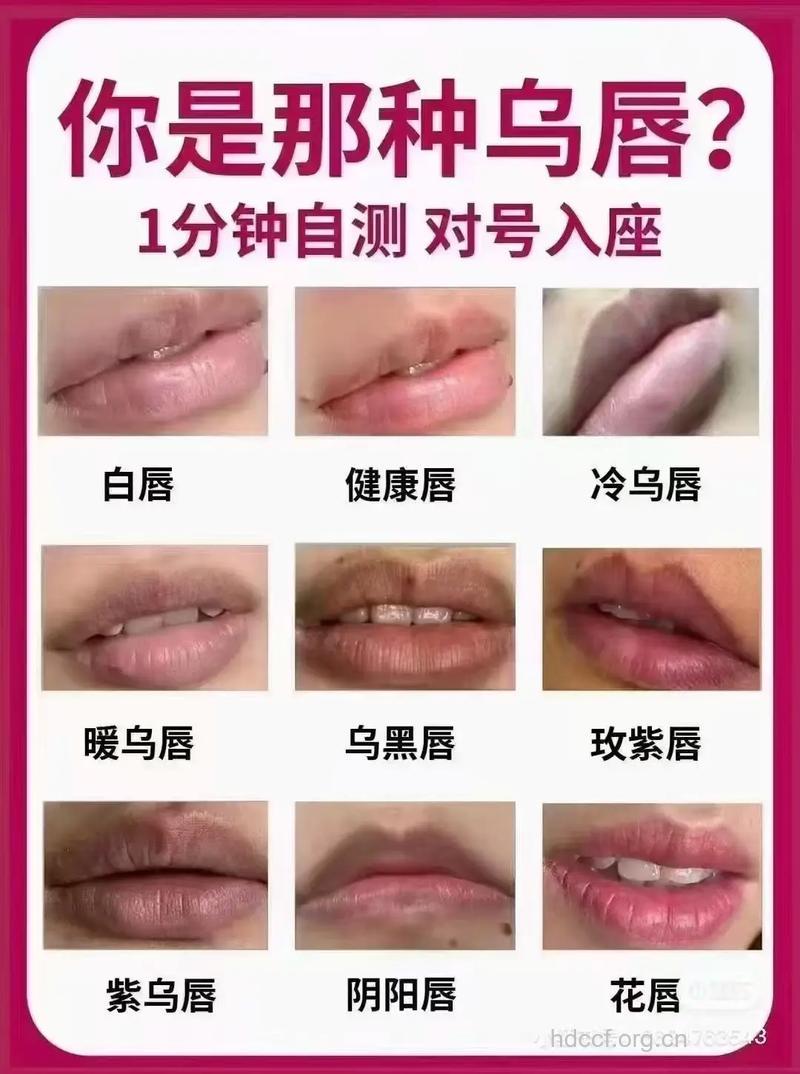 女性冬天嘴唇常发紫 小心这六大原因