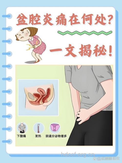 女性长时间腰酸腹痛或是盆腔炎在作祟