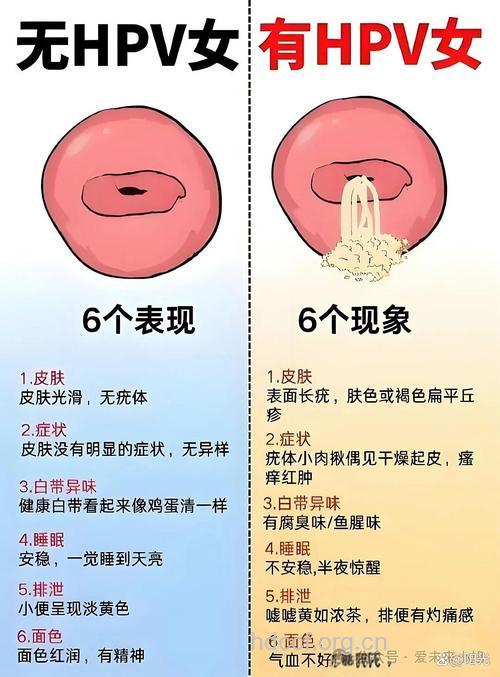 急慢性宫颈炎都有什么区别