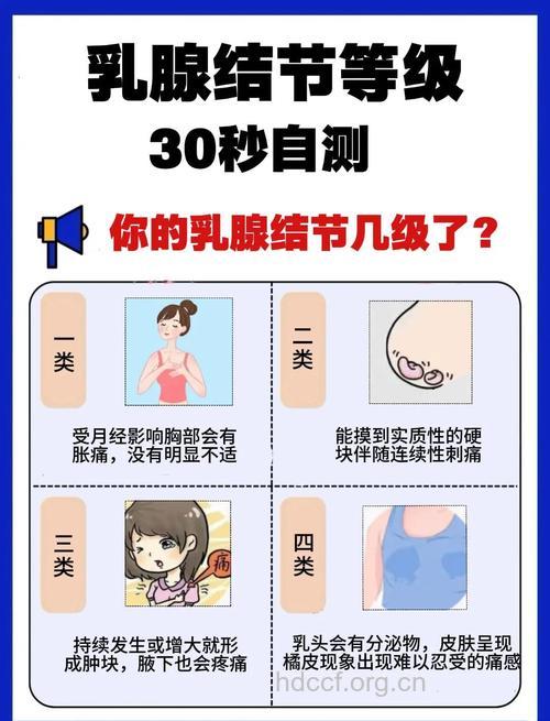 双侧乳腺小叶增生伴左乳结节怎么回事
