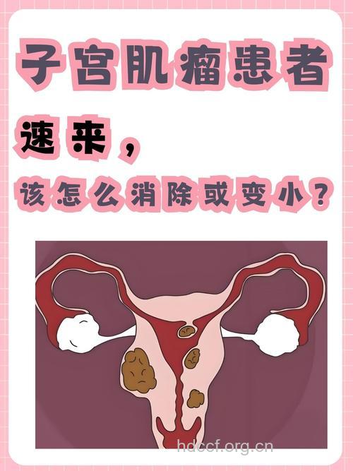 绝经后子宫肌瘤会消失吗?