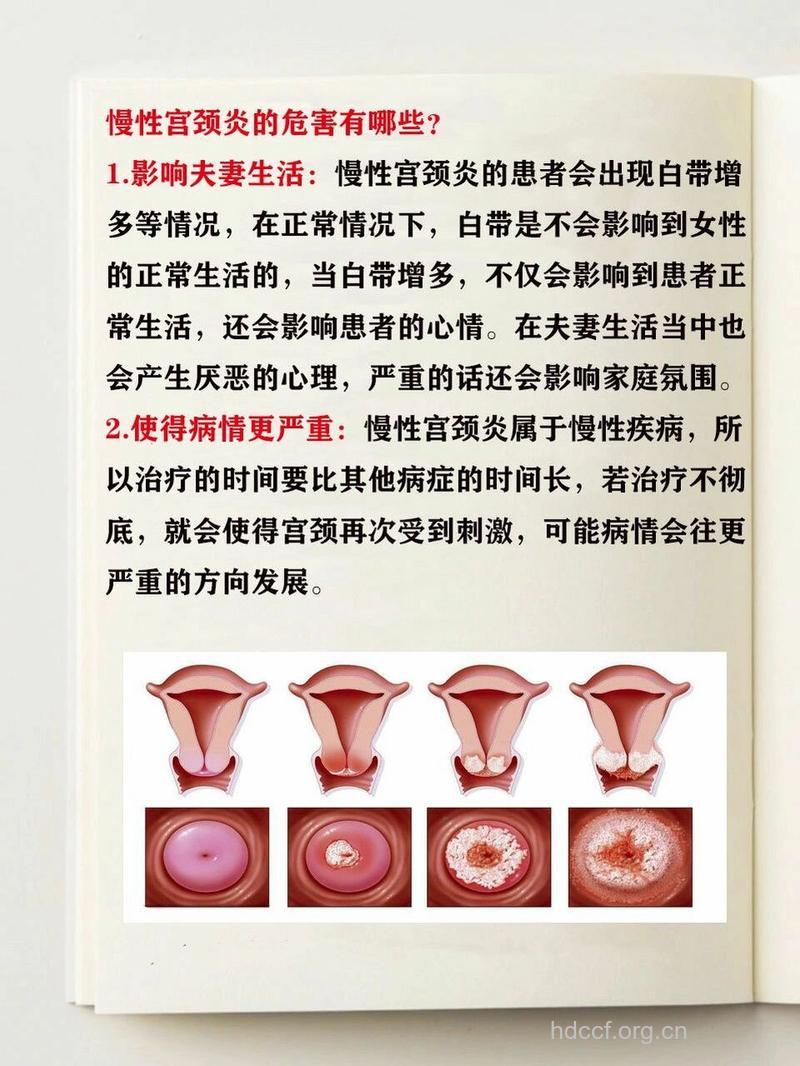 慢性宫颈炎有哪些危害