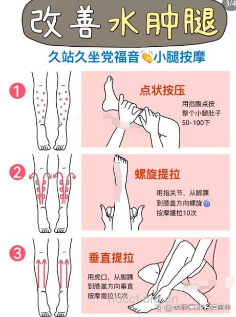 办公女性如何应对双腿浮肿