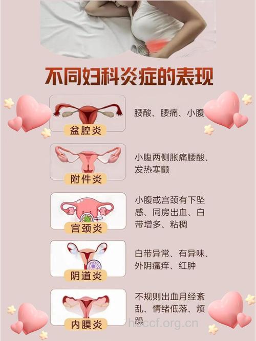 盆腔炎的三种类型