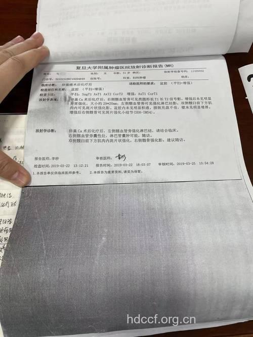 卵巢癌b超能查出来吗 三种方法能确诊