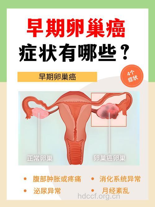 卵巢癌有哪些早期症状出现