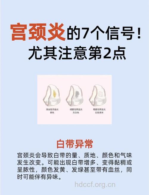 专家在线谈：宫颈炎有哪些症状