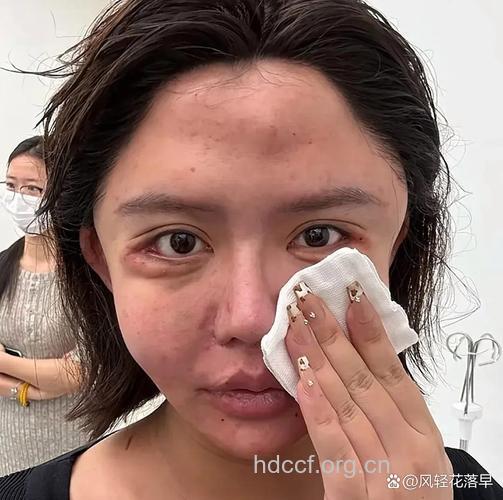 产后皮肤不好 这样做肌肤美美哒