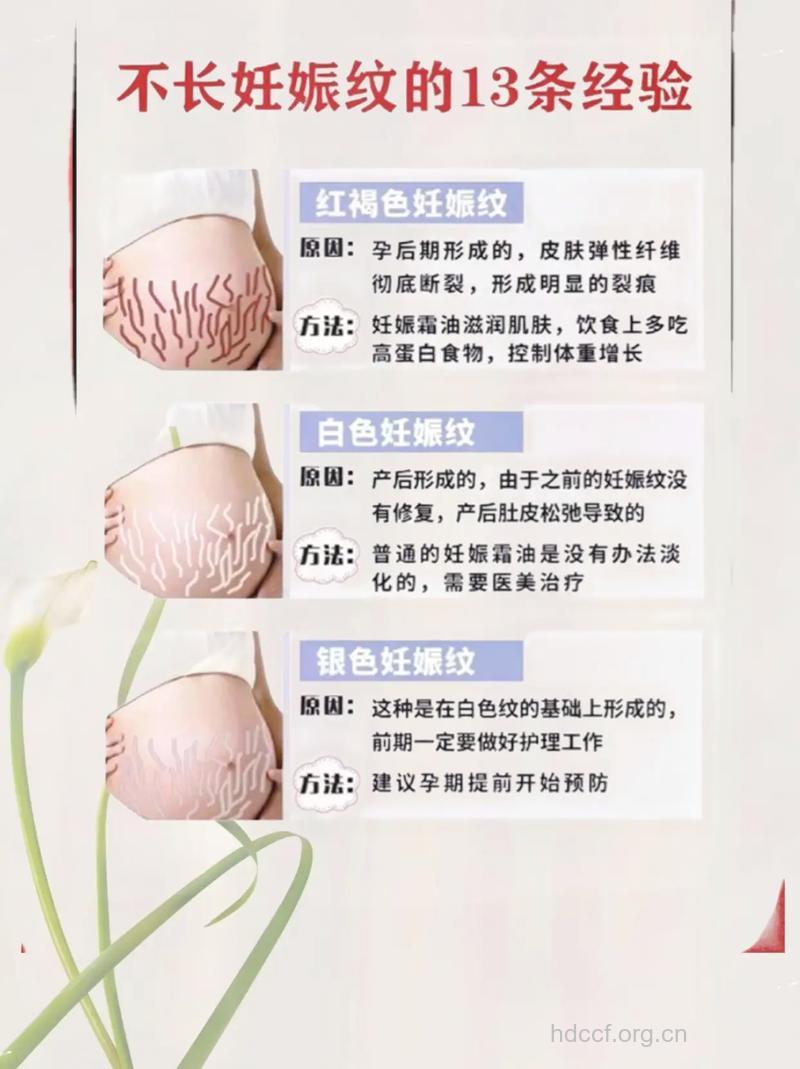 孕期为什么会长妊娠斑 3招防治妊辰纹