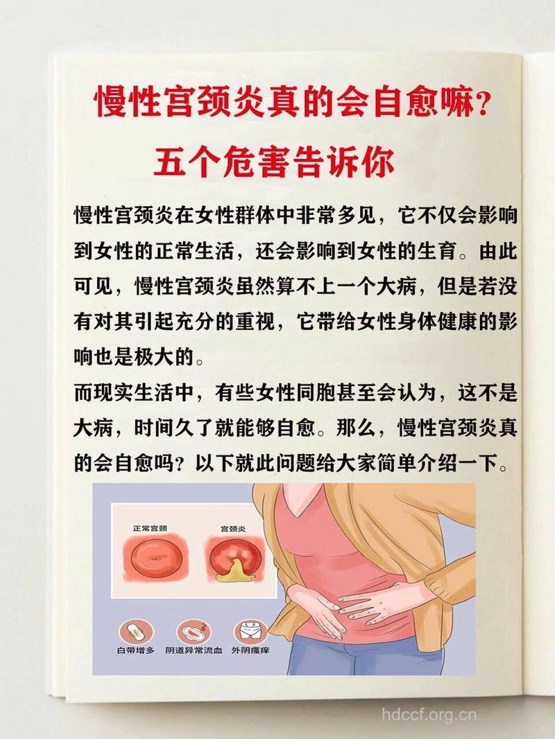 宫颈炎对女人的伤害有哪些