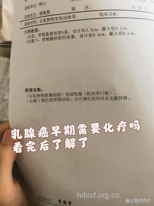 内向的女性更易患乳癌 早期诊断做哪些检查