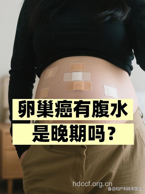 缠人的卵巢癌腹水