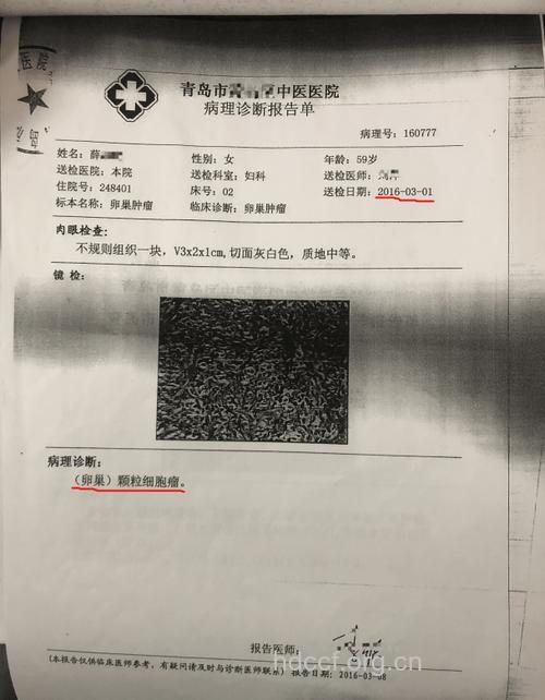 免疫学检查为诊断卵巢癌开辟新道路