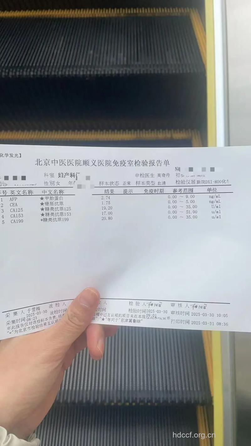 血液检测可查早期卵巢癌