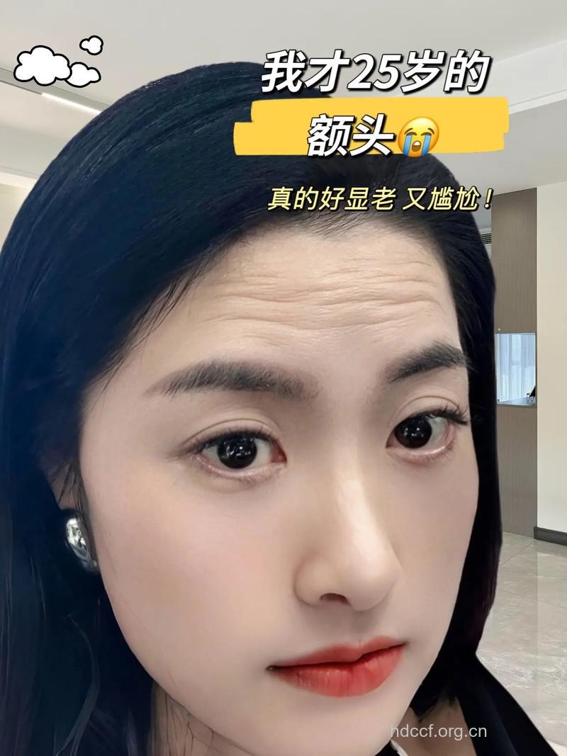 额头长皱纹和抑郁有关 女人要预防皱纹早生