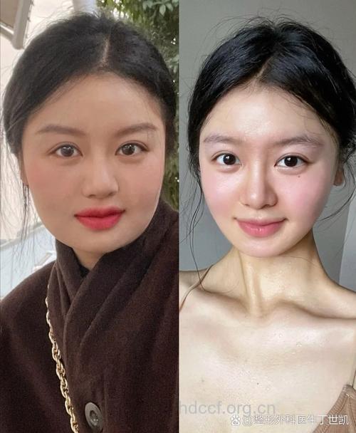 大饼脸看过来 哪些习惯让脸越来越大