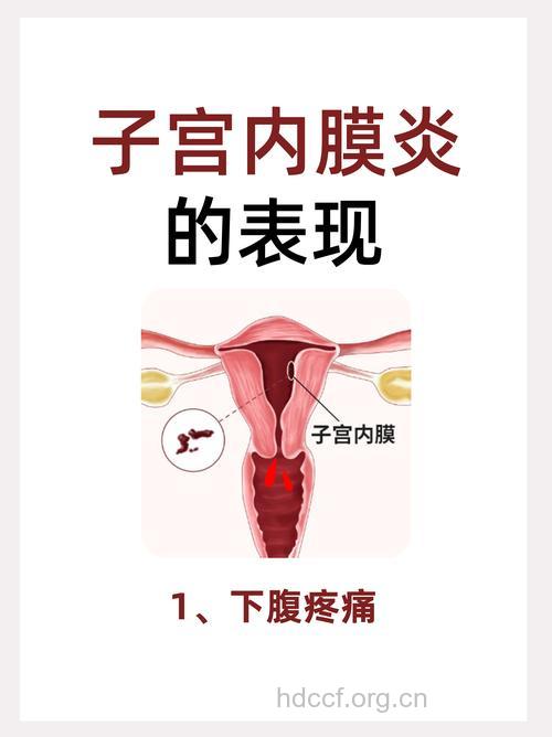 子宫内膜炎有哪些症状表现