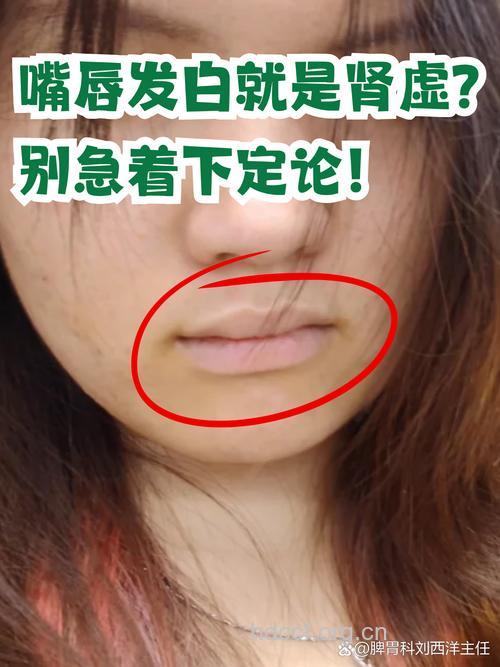 嘴唇发白怎么回事