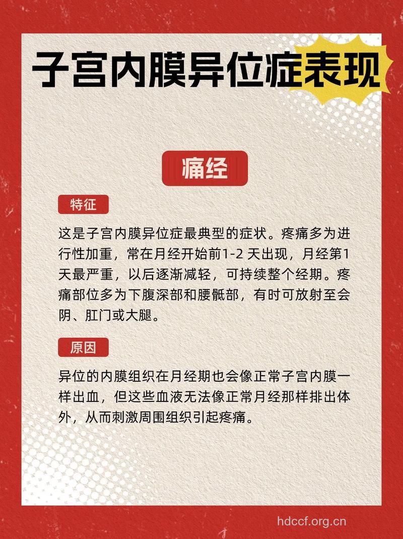 子宫内膜异位症的症状是什么 该如何预防