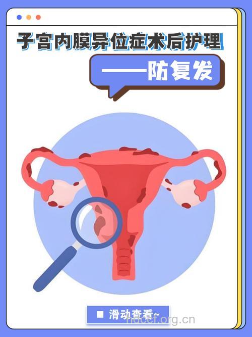 子宫内膜异位症术后怎么护理预防复发