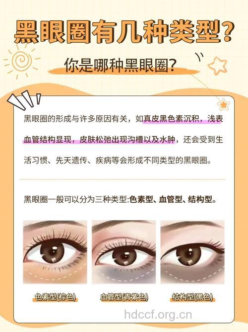 做好这几点 肤色暗黄黑眼圈统统拜拜