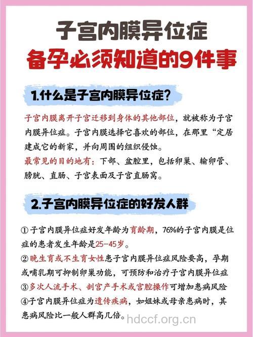 子宫内膜异位症的西医治疗方法