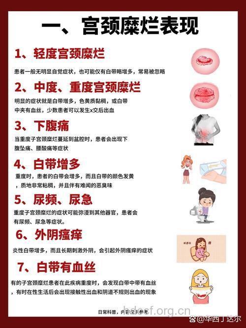 宫颈糜烂的危害 如何预防宫颈糜烂复发