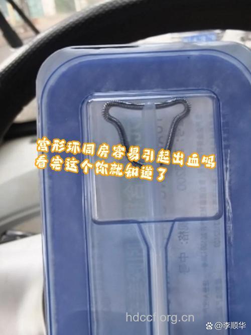 轻度宫颈糜烂能带环吗