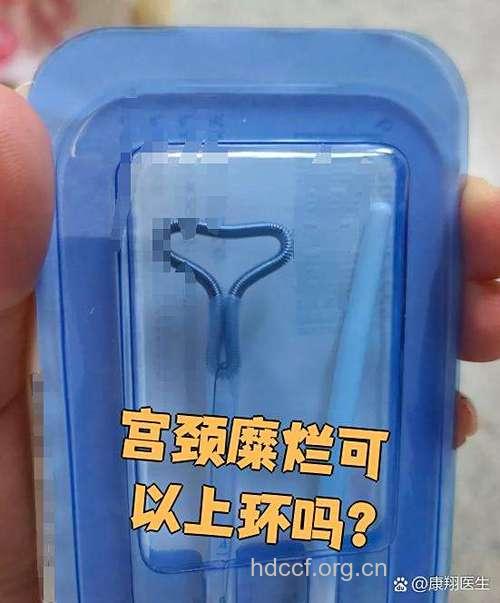 宫颈糜烂是否能带环