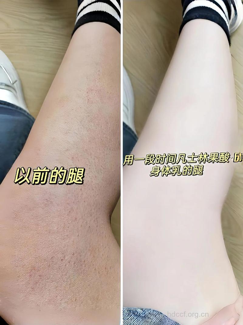 夏天频繁洗澡皮肤易老化