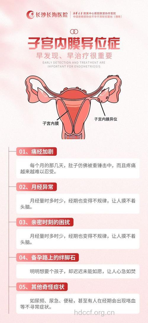 子宫内膜异位的典型症状