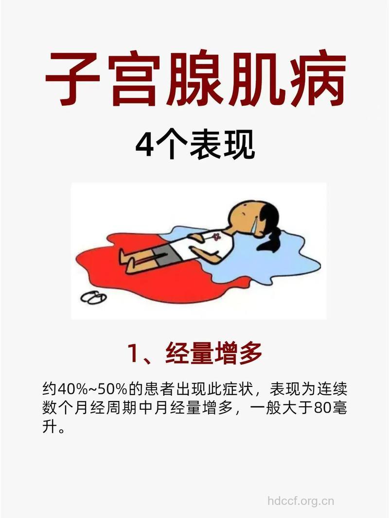 子宫腺肌症有哪些症状