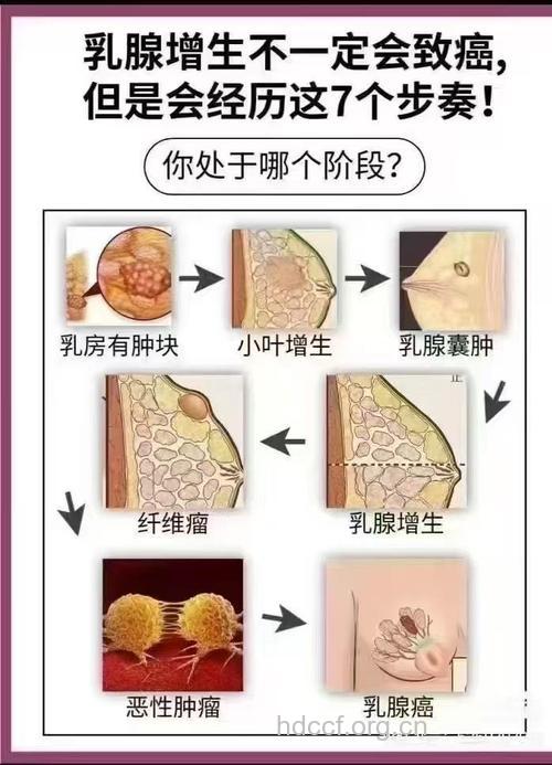 乳腺癌是如何引起的呢