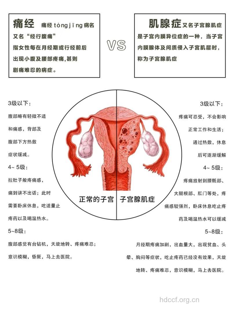 子宫腺肌病是怎么引起的