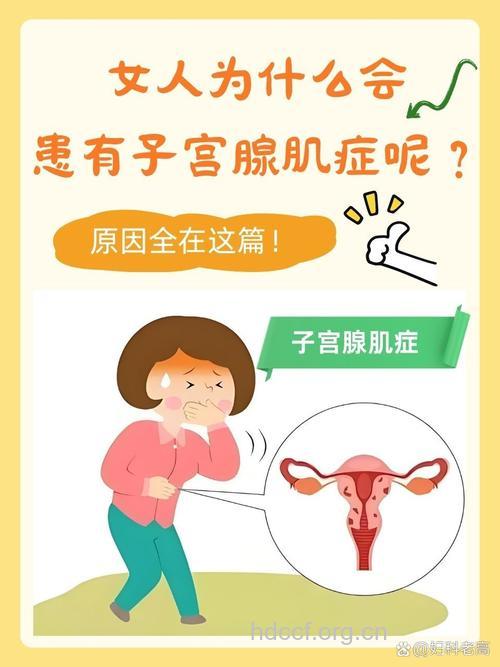 子宫腺肌症的病因有哪些