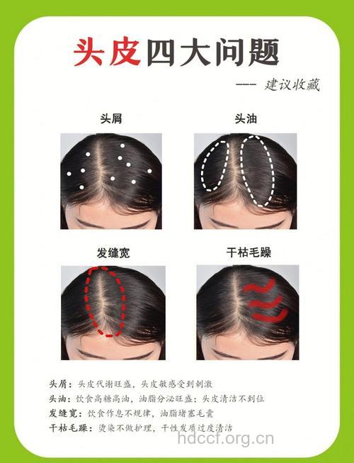 怎么用头发诊断头发方法