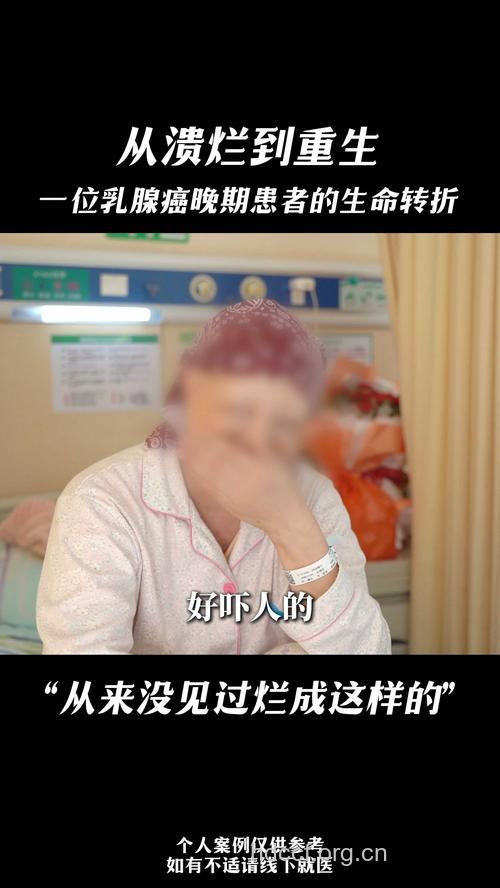 抑郁症困扰八成乳腺癌病人