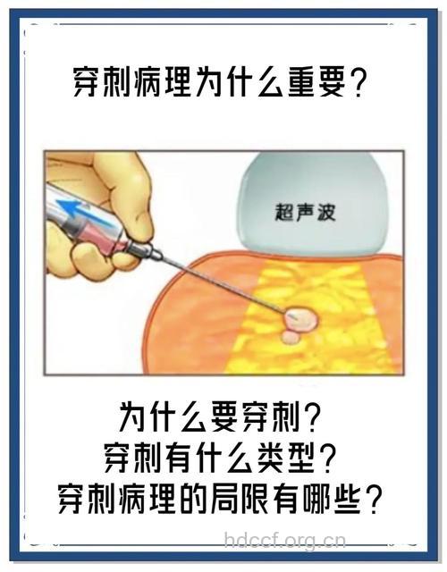 穿刺针活检对乳癌的影响
