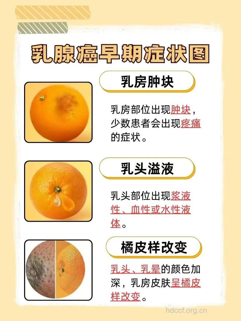 乳房患上癌症的4个“信号”