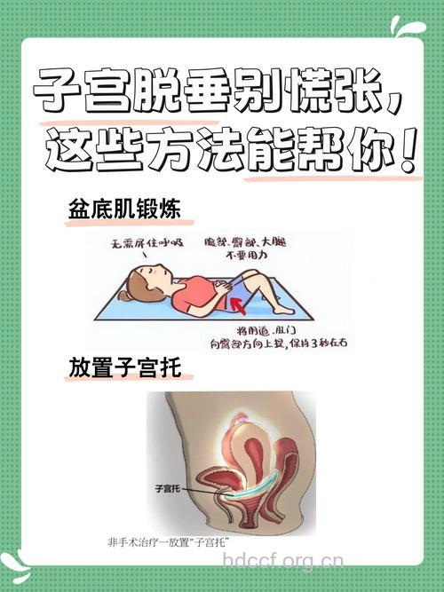 产后如何避免子宫脱垂