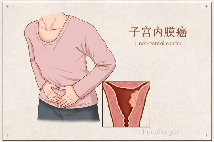 女性阴道出血是肿瘤吗