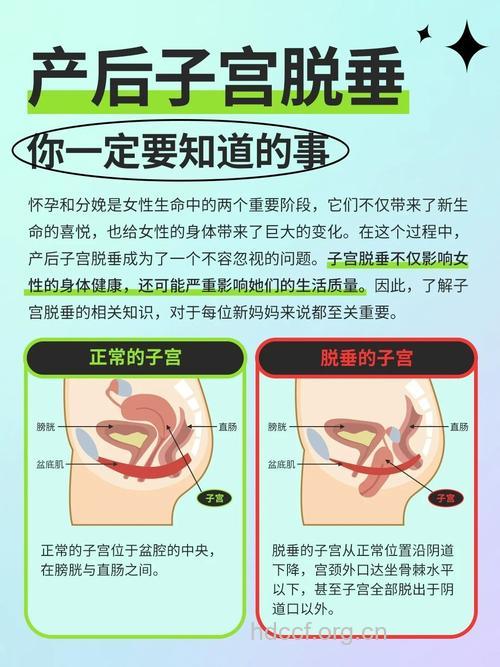 子宫脱垂是什么原因引起的