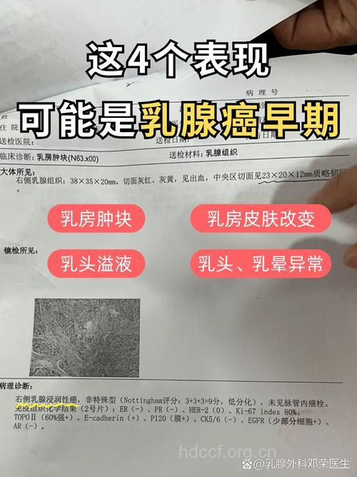 得了乳腺癌有哪些征兆