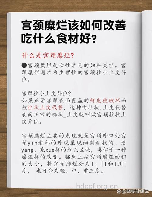 宫颈糜烂的饮食注意要点