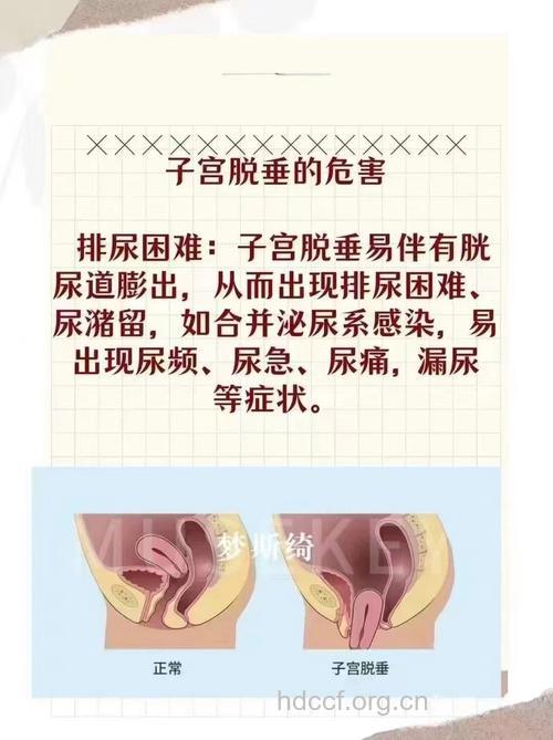 子宫脱垂对老人有哪些危害