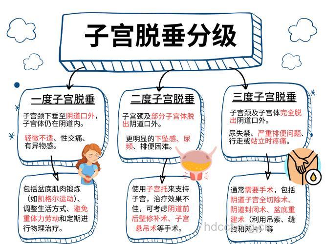 子宫脱垂有哪些常见级别