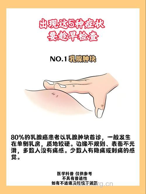 乳腺癌有什么早期症状表现