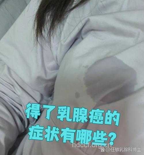 主要乳腺癌的早期症状表现