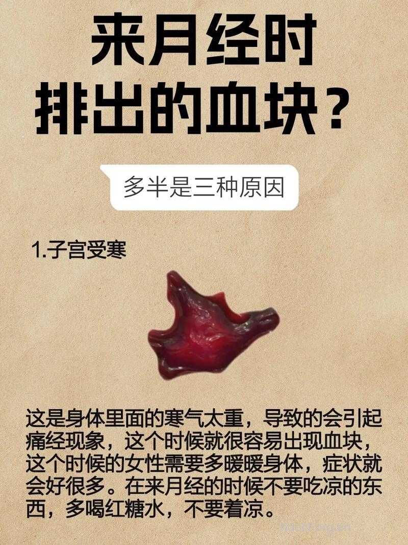 大姨妈变成这个样子 说明你该补血了