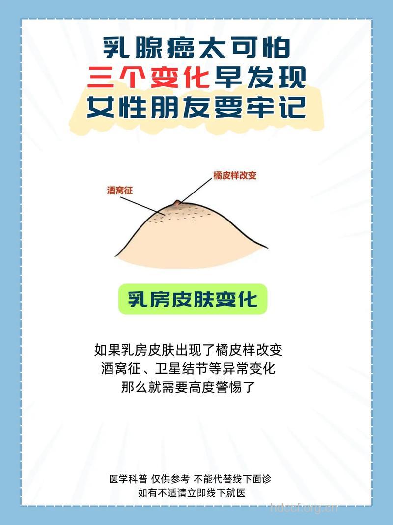 乳腺癌的表现有哪些